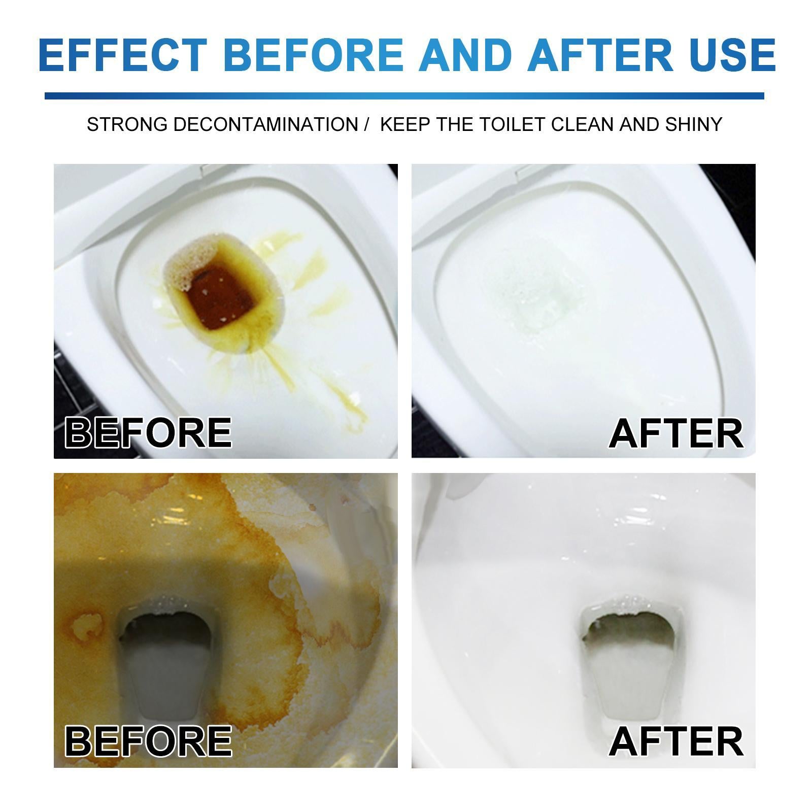 Jueyu Toilet Cleaning Tablets Toilet Deodorizing and Descaling Tablets for Removing Urine Stains and Cleaning Drains